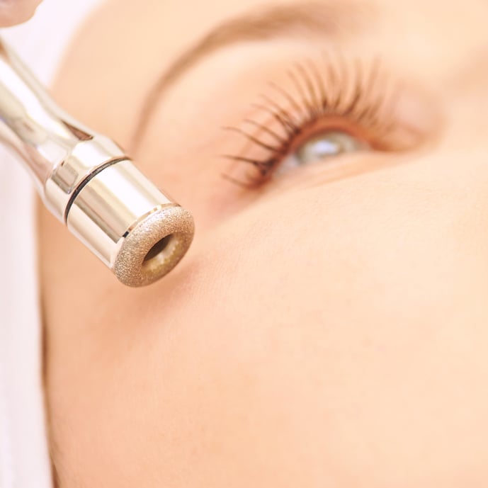 Microdermabrasion Procedure on a Woman's Face Up Close